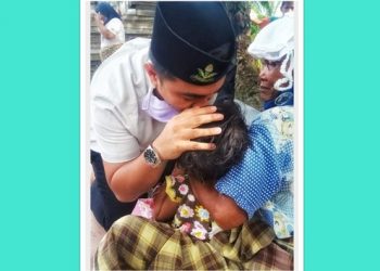 Pemuda Muhammadiyah Tapteng Bantu Anak Penderita ‘Hydrosefalus’