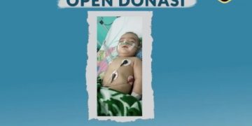 Lazismu Medan Buka Donasi untuk Bantu Anak Penderita Meningitis TB